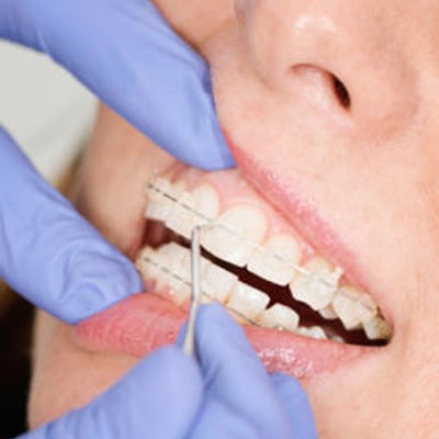 Orthodontics-img